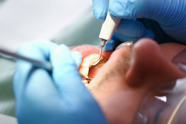 Best Emergency Treatment for Toothache in Richmond, CA